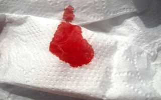 Вагинальное кровотечение на раннем сроке беременности